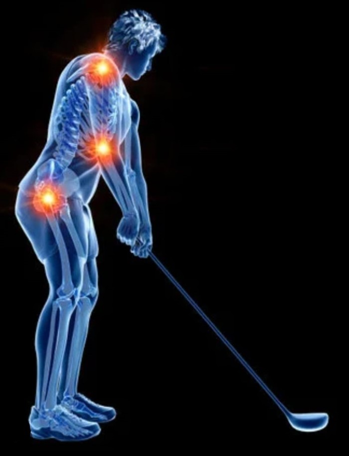 Lumbalgia y Golf: Factores de riesgo.